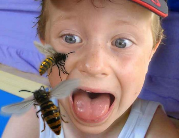 Boy attacked by wasps picture by Mick Robertson